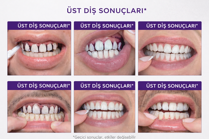 NEVORLA® - Beyazlık Bakım Seti