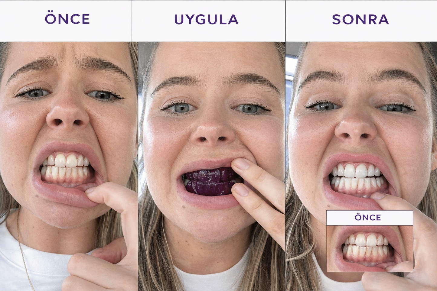 NEVORLA® - Premium Beyazlık Seti